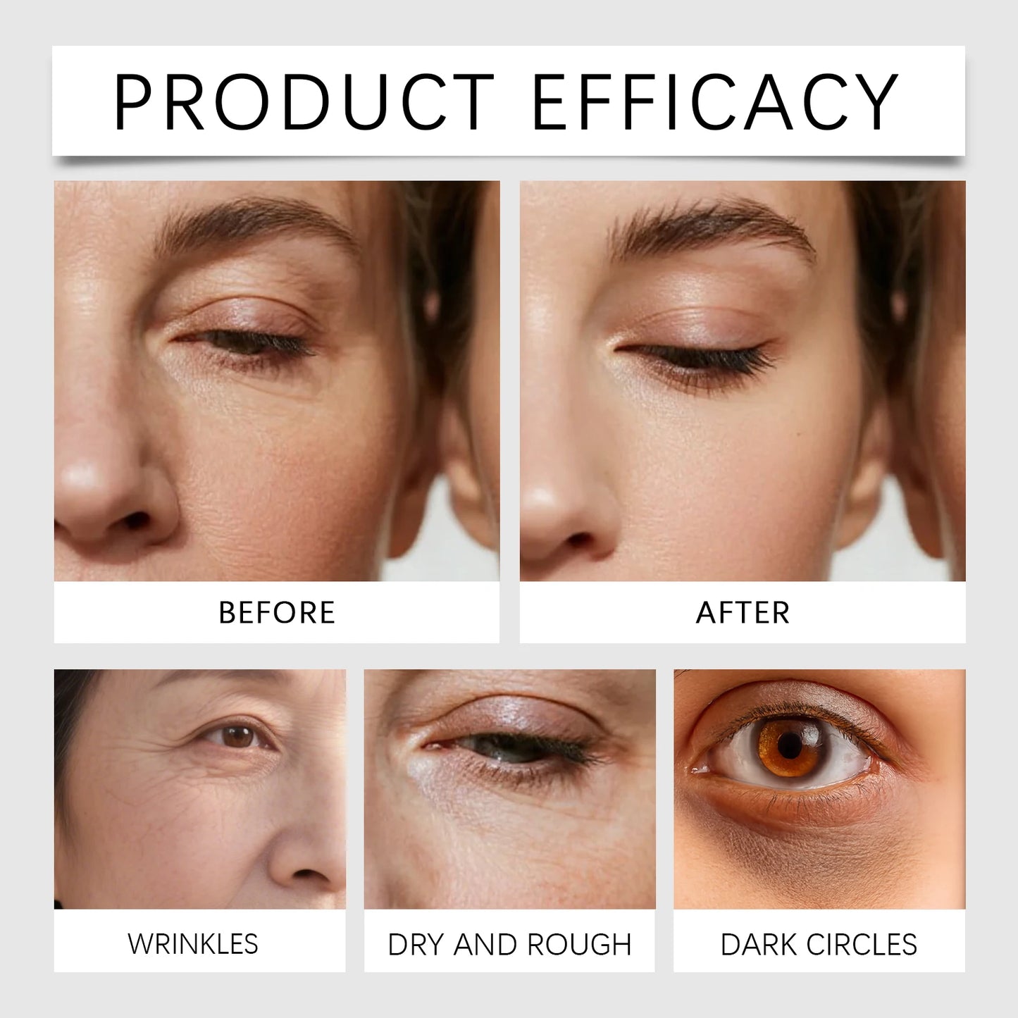 Eye-Lift Calcium Patches Instant Volume Boost & Brightening,Refreshing Hydrogel Mask for Tired Eye,Vegan & Cruelty-Free Skincare