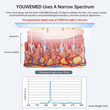 YOUWEMED 311nm Ultraviolet Phototherapy Instrument use UVB Lamp UV for Vitiligo Psoriasis White Spots Skin Disease